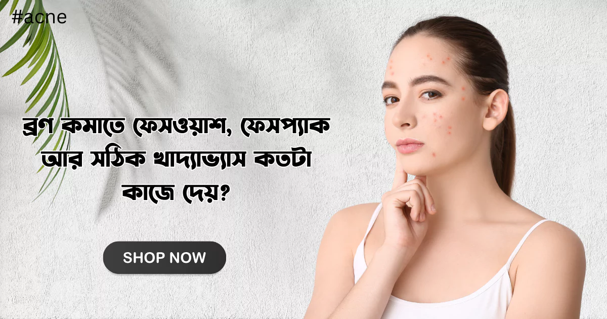 ব্রণ কমাতে ফেসওয়াশ, ফেসপ্যাক আর সঠিক খাদ্যাভ্যাস কতটা কাজে দেয়?