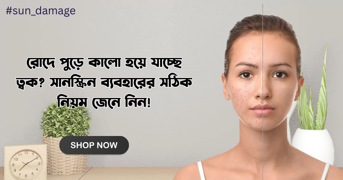 রোদে পুড়ে কালো হয়ে যাচ্ছে ত্বক? সানস্ক্রিন ব্যবহারের সঠিক নিয়ম জেনে নিন! 