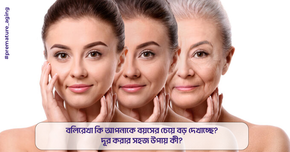 বলিরেখা কি আপনাকে বয়সের চেয়ে বড় দেখাচ্ছে? দূর করার সহজ উপায় কী?"