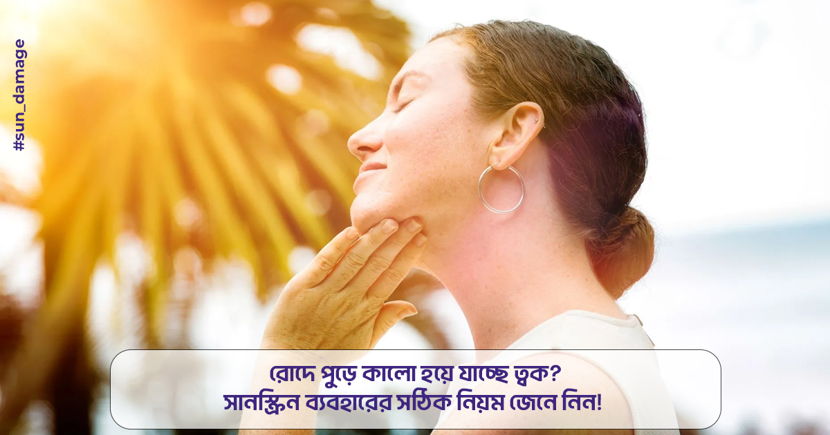 রোদে পুড়ে কালো হয়ে যাচ্ছে ত্বক? সানস্ক্রিন ব্যবহারের সঠিক নিয়ম জেনে নিন! 