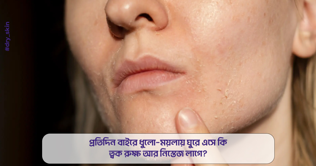 প্রতিদিন বাইরে ধুলো–ময়লায় ঘুরে এসে কি ত্বক রুক্ষ আর নিস্তেজ লাগে?